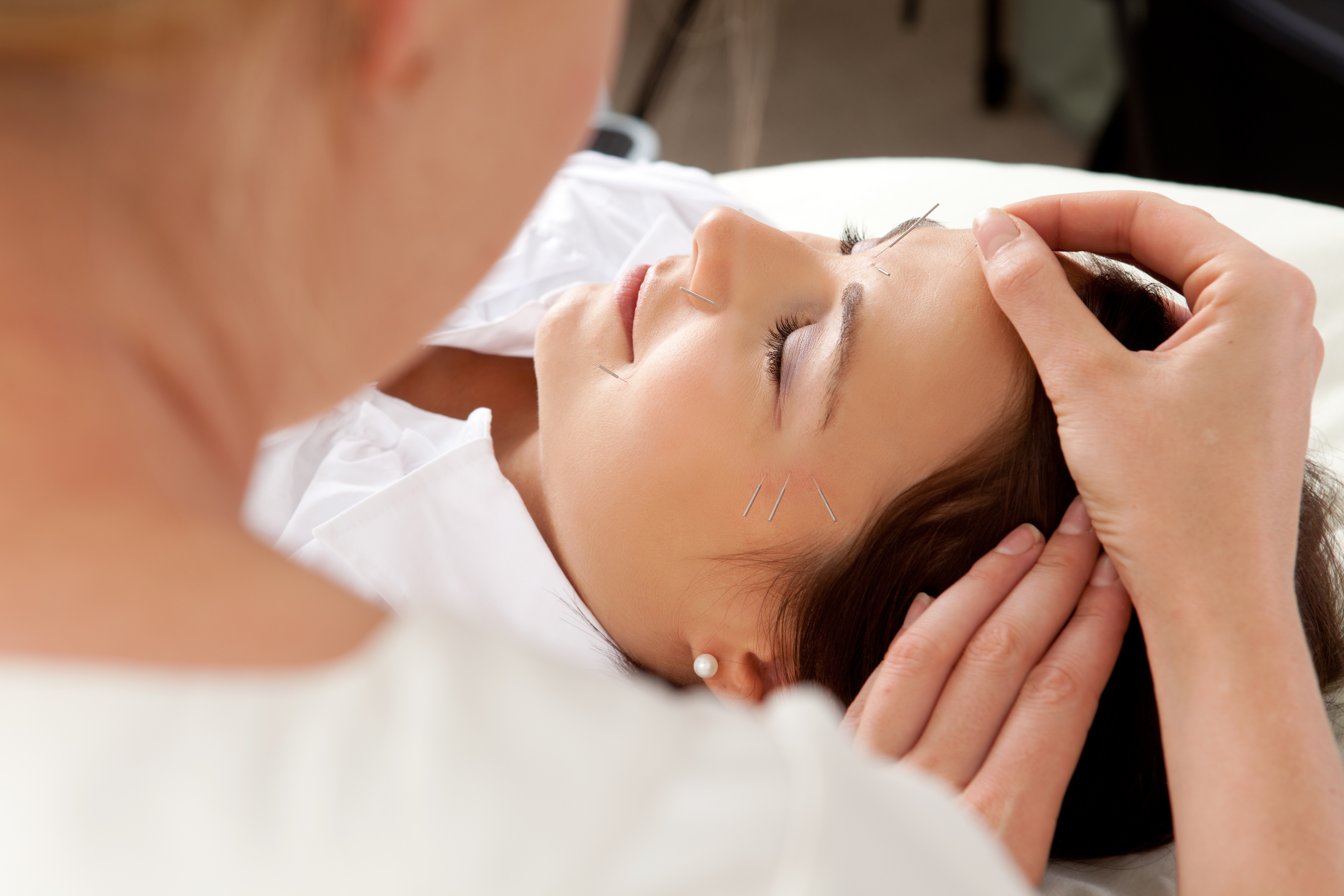 Acupuncture Facial